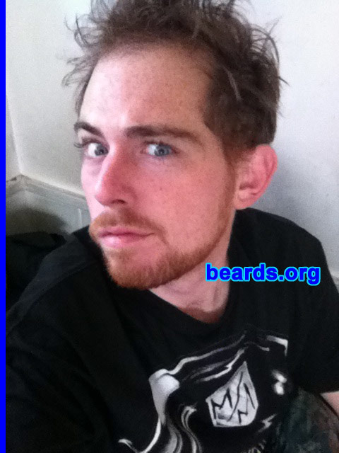 Justin M.
Bearded since: 2012. I am a dedicated, permanent beard grower.

Comments:
Why did I grow my beard? My workplace finally allowed closely-trimmed and well-groomed facial hair.

How do I feel about my beard? I wish I was allowed to have it bushier. Gingerbeard for life!
Keywords: full_beard