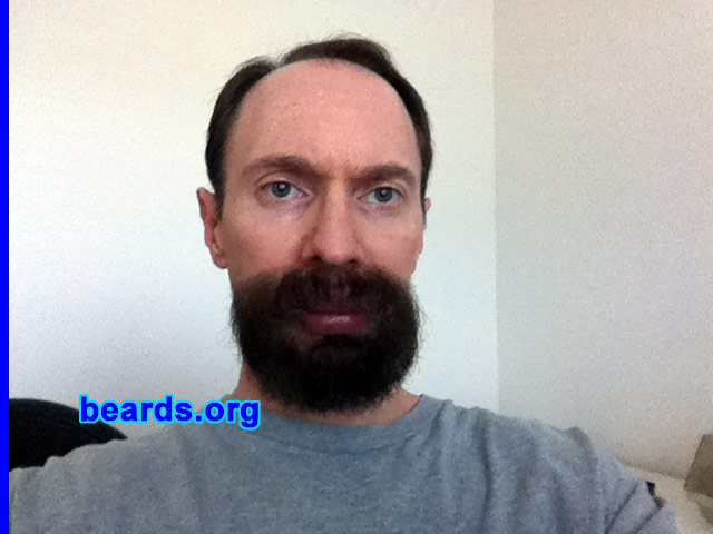 Mark
Bearded since: 2010. I am an experimental beard grower.

Comments:
I grew my beard because I've been fascinated by facial hair since I was a kid. I've even had a couple of facial hair transplants to increase my coverage.

How do I feel about my beard? I like it, but I'm looking forward to growing more hair soon. I had a third transplant procedure a couple of months ago, so I should be sprouting new hairs in just a few weeks.
Keywords: goatee_mustache