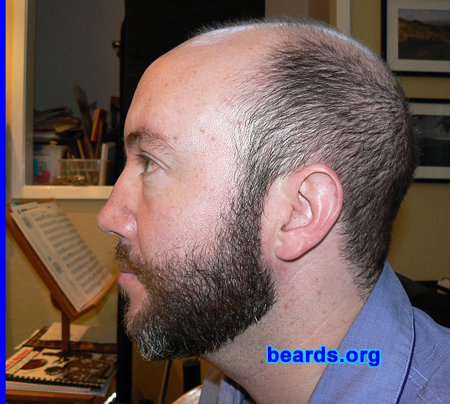 Tim
Bearded since:  2007.  I am an experimental beard grower.

Comments:
I've never grown a beard before and thought why not. Here's my beard at six weeks of growth.

I'm liking my beard more and more. I'm starting to shape it now.
Keywords: full_beard