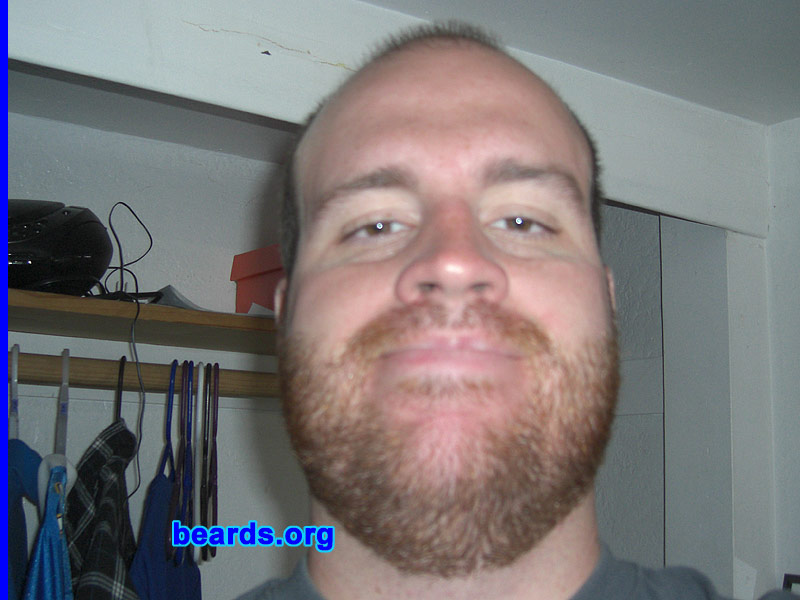 Travis R.
Bearded since: 2010.  I am a dedicated, permanent beard grower.

Comments:
I grew my beard because I felt shavers cost too much and I look good with one anyway.

How do I feel about my beard? Great.  It gives me that pioneer look I want.
Keywords: stubble full_beard