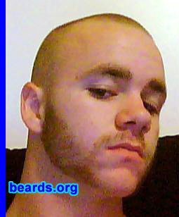 Greg P.
Bearded since: 2008.  I am a dedicated, permanent beard grower.

Comments:
I grew my beard because I have always loved beards and I like to make my non-bearded friends jealous.

How do I feel about my beard? I love it and don't feel the same without it.
Keywords: mutton_chops