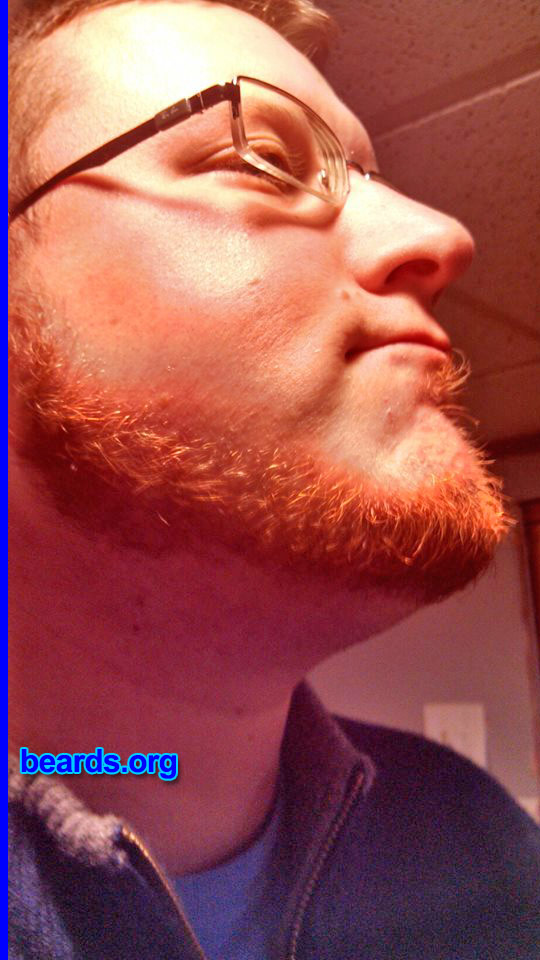 Joseph
Bearded since: 2010. I am an experimental beard grower.

Comments:
Why did I grow my beard? To see if it would grow in all the way.

How do I feel about my beard? I love my beard.  I have Irish heritage.  So it's only fitting that I would have a reddish beard.
