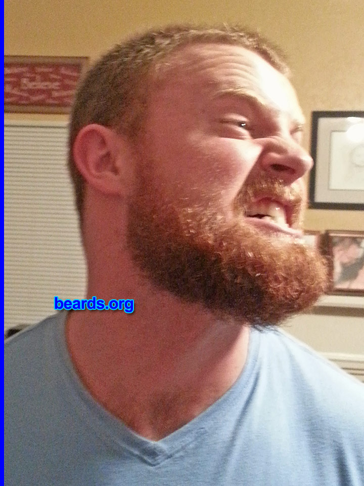 Keith M.
Bearded since: 2012. I am a dedicated, permanent beard grower.

Comments:
Why did I grow my beard? Because I'm a man.

How do I feel about my beard? I love my bulky ginger beard.
Keywords: full_beard