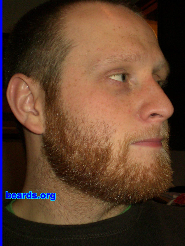 Brian W.
Bearded since: 1998. I am a dedicated, permanent beard grower.

Comments:
I grew out my beard originally because I could. I was one of the few high school kids that could grow a full beard. "Teen Wolf", "Wolf Man", and "Grizzly Adams" were a few of my nicknames... lol

How do I feel about my beard? I love my beard...although the coloration of my facial hair is a bit unusual.
Keywords: full_beard