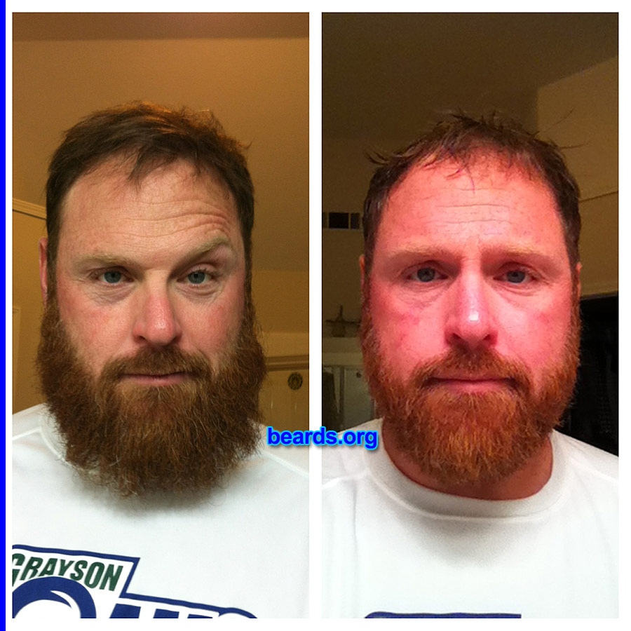 Brent T.
Bearded since: 2010. I am a dedicated, permanent beard grower.

Comments:
Why did I grow my beard? Grew it out before my first half-marathon.  Trimmed it afterwards.

How do I feel about my beard? Love it.  Hate that I trimmed it off!
Keywords: full_beard