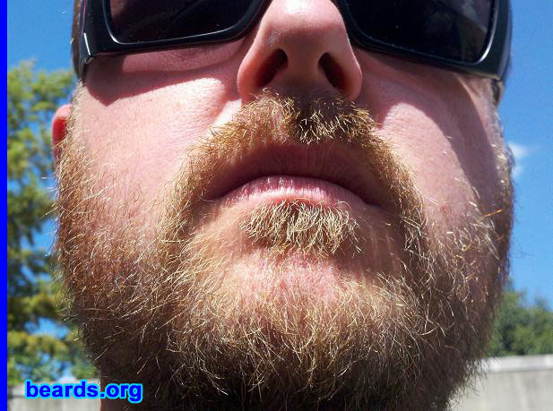 Alfred
Bearded since: 2011. I am an experimental beard grower.

Comments:
This beard that I'm growing is more of an experiment. I have started a video journey and have taken daily footage of the growth of my beard. I'm a "YouTuber" and have seen many videos about beards, but mine will be the most EPIC, I promise. :)

How do I feel about my beard? I feel fairly good about my beard. The only real complaint I have about my beard is the color (reddish tint), that it's not the same as my head color. It's all good in the hood though.
Keywords: full_beard