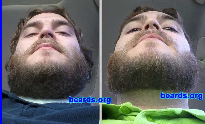 Matt H.
Bearded since: 2012.  I am an experimental beard grower.

Comments:
I grew my beard because I became single and my ex-girlfriend didn't like facial hair. I also just started a new job and my boss doesn't care if I grow a beard.

How do I feel about my beard? This is my first full beard. I was unsure about creating a neck line.  But after going to a barber, I can totally see a difference and the importance of creating a neck and cheek line. I've attached pics showing the difference.
Keywords: full_beard