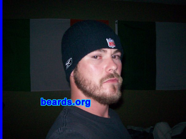 Dustin
Bearded since: 2010. I am an occasional or seasonal beard grower.

Comments:
I grew my beard because I was bored and it was cold.

How do I feel about my beard? Couldn't wait to shave it...
Keywords: full_beard