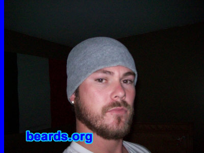 Dustin
Bearded since: 2010. I am an occasional or seasonal beard grower.

Comments:
I grew my beard because I was bored and it was cold.

How do I feel about my beard? Couldn't wait to shave it...
Keywords: full_beard