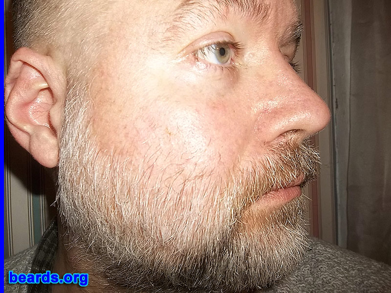 James M.
Bearded since: 2013. I am an experimental beard grower.

Comments:
Why did I grow my beard? Tired of shaving.

How do I feel about my beard? I am going to keep it for a year. I would like to have it longer. It has been thirty-two days since I have shaved. Even though I don't like the gray, I plan on keeping it natural. I am eventually wanting three-to-four inches in length in the front and shorter on the sides so I wont have to shave the neck line.
Keywords: full_beard