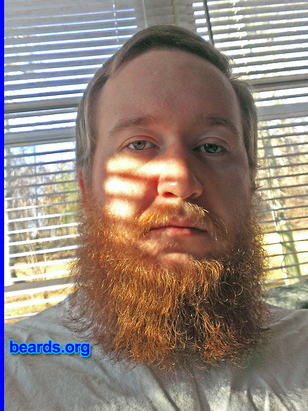 Tyler B.
Bearded since: 2013. I am a dedicated, permanent beard grower.

Comments:
Why did I grow my beard?  Because I'm a man, not a baby-faced girl.

How do I feel about my beard? I love it but I wish my mustache were fuller.
