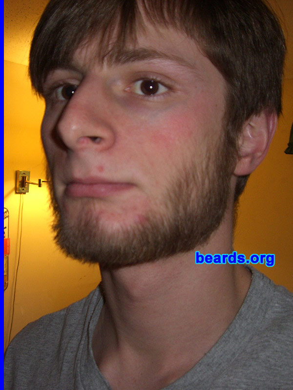 Dale
Bearded since: 2001--2002 or so.  I am a dedicated, permanent beard grower.

Comments:
I grew my beard because I'm meant to have a beard.

How do I feel about my beard?  I love my beard!
Keywords: chin_curtain