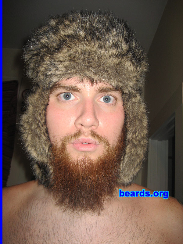 Matthew L.
Bearded since: winter 2007.  I am an occasional or seasonal beard grower.

Comments:
I grew my beard to block the sun.

How do I feel about my beard?  I LOVE IT!
Keywords: full_beard