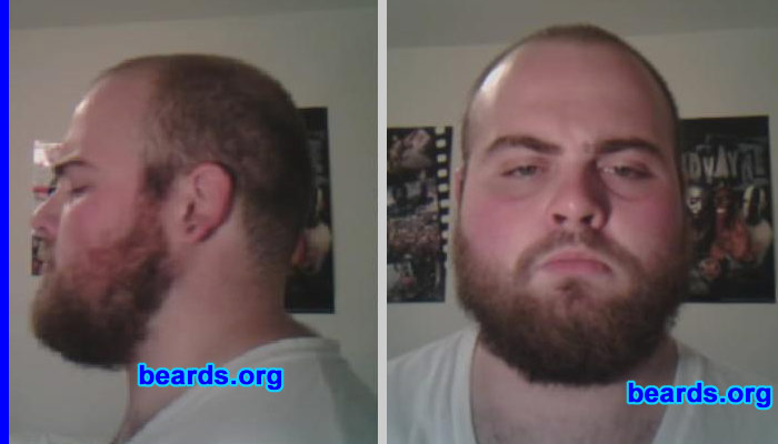 Chris H.
Bearded since: 2005.  I am a dedicated, permanent beard grower.

Comments:
I grew my beard because beards are awesome.

How do I feel about my beard?  It is the first time I'm letting it GO.  And I love every minute of it.
Keywords: full_beard