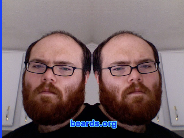 Michael
Bearded since: 2001.  I am a dedicated, permanent beard grower.

Comments:
I grew my beard because I have a weak chin.

How do I feel about my beard?  Love it.
Keywords: full_beard