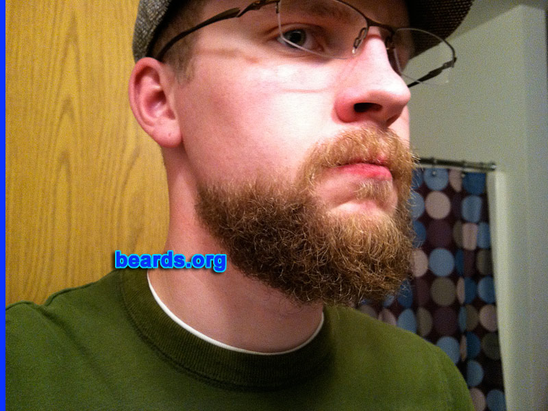 Jarred
Bearded since: 2010. I am an experimental beard grower.

Comments:
I always wanted to grow a beard, but my sideburns/cheeks were too thin. Then I visited this site and came across the beard styles section. I decided that I could grow the tailback due to weak sideburns/cheeks and fulfill my my beard needs.

How do I feel about my beard? I am very happy with the results and decided to keep the tailback/Hollywoodian look. 
Keywords: goatee_mustache