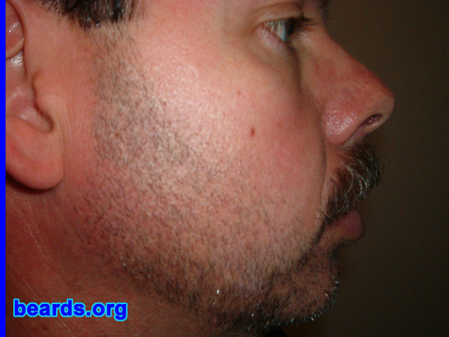 Bill
Bearded since: 2005. I am an occasional or seasonal beard grower.

Comments:
I grew my beard for winter warmth and a change of looks. I have not grown a beard in over 25 years because my wife didn't like it. But that was then. This is now.

I have had a beard in the past and enjoyed it. This one is 2 days old. 
Keywords: goatee_mustache