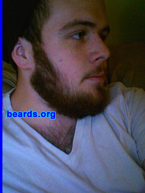 John
Bearded since: 2008.  I am a dedicated, permanent beard grower.

Comments:
I had wanted to grow a beard since my early teenage years. By fifteen, my sideburns had come in and I was loving life. However, I was still missing patches with regards to a full beard. As years progressed, I experimented with a number of different types of facial hair. However, all I truly wanted was a full beard. Right around my 18th birthday (March 2008), I decided that it was time. Although my beard is not 100% full, I felt I had enough to begin growth.

How do I feel about my beard?  I feel as though my beard completes my appearance. I have felt facially naked for years. Now that I have a beard growing in, I can't imagine my life without it. I feel more confident, masculine, and fulfilled.
Keywords: full_beard