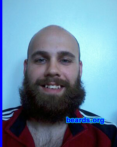 Victor I.
Bearded since: 2013. I am a dedicated, permanent beard grower.

Comments:
Why did I grow my beard? Because of my hair loss. I am only twenty-three, so I wanted to see some hair!!!

How do I feel about my beard? I love it! I can't wait for it to get longer. It just entered the "brushable" stage and I'm in it for the long haul.
Keywords: full_beard