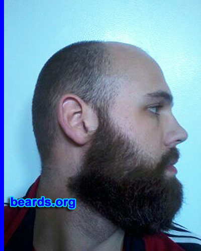 Victor I.
Bearded since: 2013. I am a dedicated, permanent beard grower.

Comments:
Why did I grow my beard? Because of my hair loss. I am only twenty-three, so I wanted to see some hair!!!

How do I feel about my beard? I love it! I can't wait for it to get longer. It just entered the "brushable" stage and I'm in it for the long haul.
Keywords: full_beard