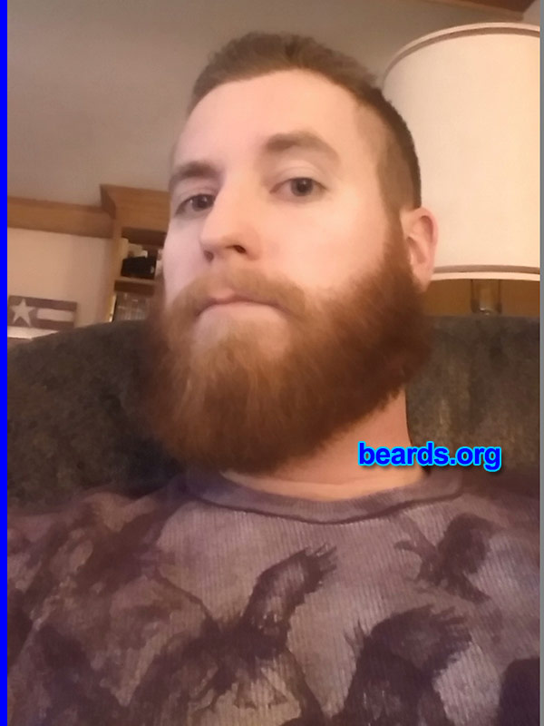 Matthew S.
Bearded since: 2013. I am a dedicated, permanent beard grower.

Comments:
Why did I grow my beard? To keep my face warm during this winter and to establish a unique look that only my beard creates!

How do I feel about my beard? I love it. 
Keywords: full_beard