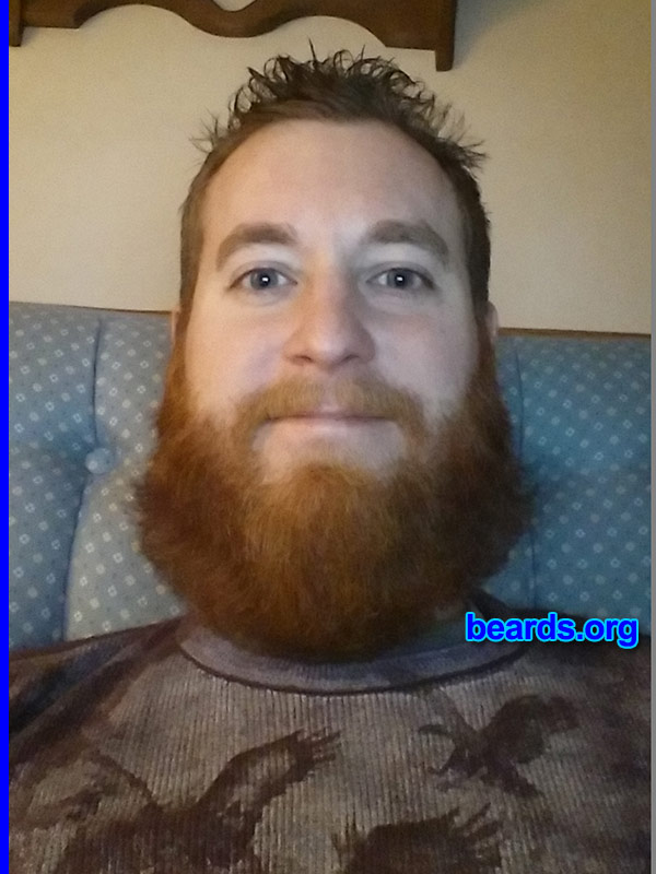 Matthew S.
Bearded since: 2013. I am a dedicated, permanent beard grower.

Comments:
Why did I grow my beard? To keep my face warm during this winter and to establish a unique look that only my beard creates!

How do I feel about my beard? I love it. 
Keywords: full_beard