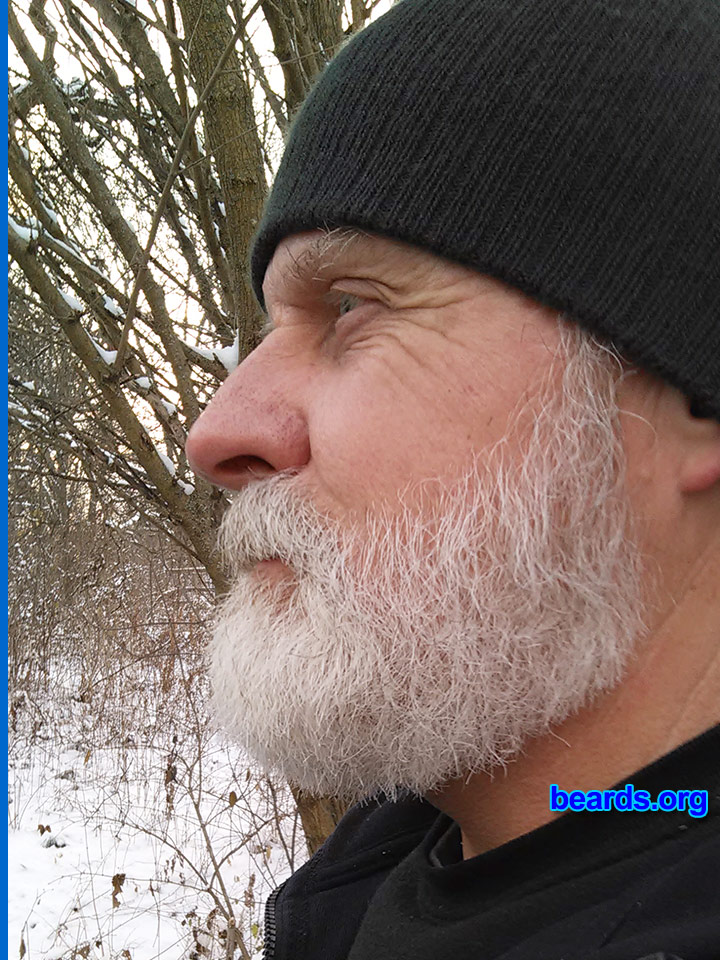 Matt F.
Bearded since: 2000. I am an occasional or seasonal beard grower.

Comments:
Why did I grow my beard? I prefer how I look with a beard.

How do I feel about my beard? I would rather it was not as white but overall I like it.
Keywords: full_beard