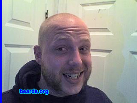 Brandon Helmer
Bearded since: 2000.  I am a dedicated, permanent beard grower.

Comments:
I grew my beard because all the men in my family have beards of one type or another.

How do I feel about my beard?  I love it, especially when it gets longer and the red shows out more.
Keywords: mutton_chops
