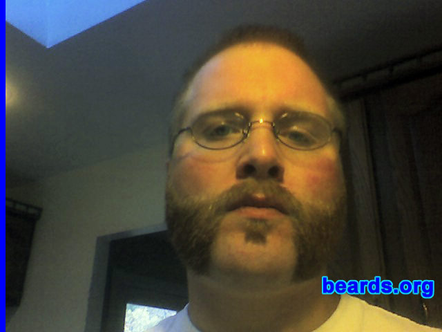 Severn W.
Bearded since: 1992.  I am a dedicated, permanent beard grower.

Comments:
Always had a beard since I could grow one (around age twelve to fourteen).

How do I feel about my beard?  As much a part of me as anything else.
Keywords: soul_patch mutton_chops