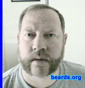 Adrian
Bearded since: 2009.  I am a dedicated, permanent beard grower.

Comments:
After retiring from the Army, I thought I'd try growing a beard for the first time.

How do I feel about my beard? I love it.
Keywords: mutton_chops