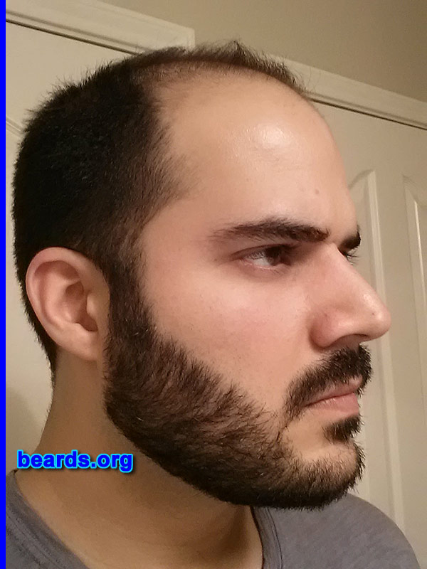 Amier Ali S.
Bearded since: 2001. I am an occasional or seasonal beard grower.

Comments:
Why did I grow my beard? For fun, just to change up my look once in a while.

How do I feel about my beard? Great!
Keywords: full_beard