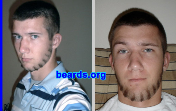 Billy
Bearded since: 2006.  I am an experimental beard grower.

Comments:
I grew my beard for a college project.

Felt good.
Keywords: chin_curtain customized