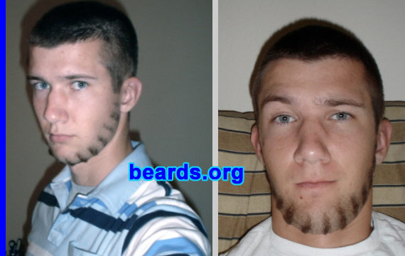 Billy
Bearded since: 2006.  I am an experimental beard grower.

Comments:
I grew my beard for a college project.

Felt good.
Keywords: chin_curtain customized