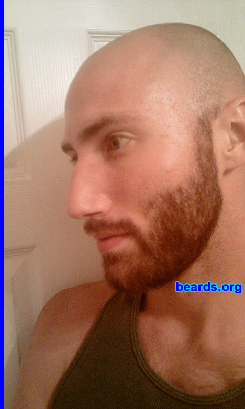 B.H.
Bearded since: 2010.  I am a dedicated, permanent beard grower.

Comments:
I grew a beard simply because I had grown almost everything else since I was eighteen.  It was predestined actually.  I have extremely sensitive skin; terrible breakouts and razor burn if a razor even touched my face, bad for days upon end.  I have had to use an electric razor ever since I discovered this.   I became lazier as time went on and kept going longer without trimming my facial hair.  Eventually it had been two weeks (oops!) and one of my colleagues said I looked great with a beard.  I thought, might as well try.  So I did.  I kept it for six weeks and liked it well enough, nothing amazing.  I shaved it off due to boredom, yet soon realized I missed it!  I felt different suddenly, like I was missing something, my beard!  I soon came to realize it was meant to be. I needed a beard again.  I began growing it eight weeks ago and grow even more in love with it daily.  I am certainly a dedicated beard man now.

How do I feel about my beard?  I feel like my beard is supposed to be there.  I adore it and love taking care of it.  Since I can't have hair on my head, it is really great to have it on my face.  One of the highlights of my year, discovering this fact.  I plan on growing my beard fuller and longer.  I will see where it goes from there.
Keywords: full_beard