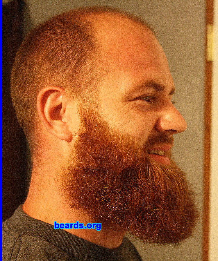 Will H.
Bearded since: 2011. I am a dedicated, permanent beard grower.

Comments:
I started out with a baby face, but as I got older and lost my hair I thought I would make up for it with a goatee. Last year my wife and I were joking around about me growing a full beard like my dad since I was on vacation. So about eight months ago I started and haven't stopped. We went through a few stages of long goatee, short full beard, etc. but people love the red and how big it is and we are always drawing attention, especially since we live in a small country town. It's always funny when people ask if I wash it and it's usually always the first thing someone asks about when they meet me. It's been an ongoing joke at my job and with family, but I am seeing just how long I can get it.

How do I feel about my beard? I love my beard full. At times it itches and drives me crazy, but overall I like having it. With age I am looking more and more like my dad, who also has a full beard, but only during certain months. I enjoy that it makes me stand out in a crowd and different than everyone else. 
Keywords: full_beard