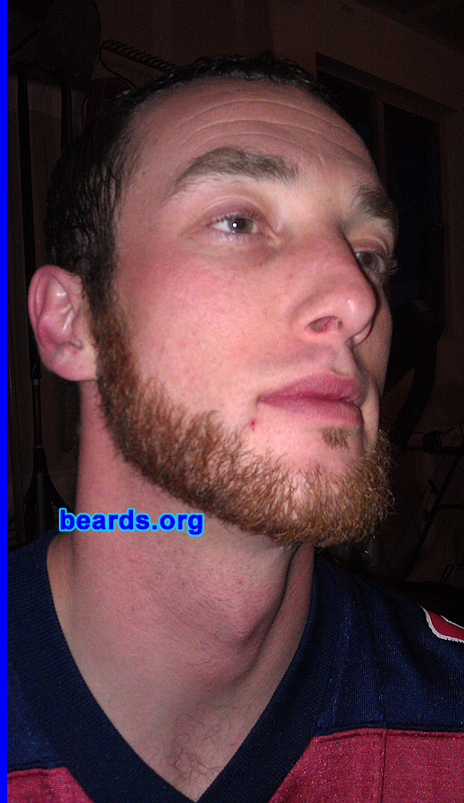 Nick
Bearded since: 2003. I am a dedicated, permanent beard grower.

Comments:
I grew my beard because women love it!

How do I feel about my beard? It is full, thick, and attractive.
Keywords: chin_curtain