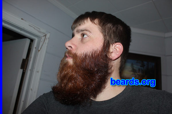 Dale
Bearded since: 2009. I am a dedicated, permanent beard grower.

Comments:
Why did I grow my beard? Had a shorter beard and wanted to see what I could do in a year. This my beard at five months.

How do I feel about my beard? Lovin' it!
Keywords: full_beard