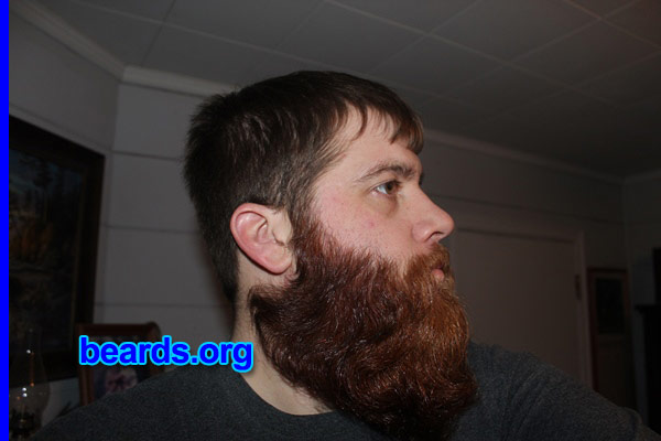 Dale
Bearded since: 2009. I am a dedicated, permanent beard grower.

Comments:
Why did I grow my beard? Had a shorter beard and wanted to see what I could do in a year. This my beard at five months.

How do I feel about my beard? Lovin' it!
Keywords: full_beard