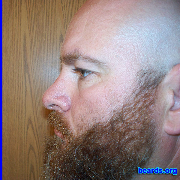 Brian
Bearded since: 2010. I am a dedicated, permanent beard grower.

Comments:
Why did I grow my beard? I hate to shave.

How do I feel about my beard? I love my beard. My wife loves my beard.
Keywords: full_beard