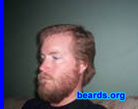 David
Bearded since: 2008.  I am a dedicated, permanent beard grower.

Comments:
I grew my beard because I like it.  I think I look better with it.  Wife likes it.

How do I feel about my beard? I like it.
Keywords: full_beard