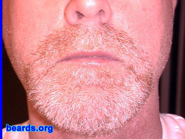 Jerry
Bearded since: January 1st, 2008.  I am an occasional or seasonal beard grower.

Comments:
I grew my beard for the ........ of it.

How do I feel about my beard? Fine!
Keywords: goatee_mustache