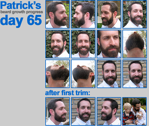 Patrick's beard progress: day 65